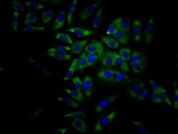 eIF4A1 Antibody (7C3), Novus Biologicals 100 &mu;g | Buy Online | Novus Biologicals | Fisher Scientific