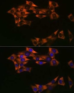 eIF4A1 Rabbit anti-Human, Mouse, Rat, Clone: 7D5K2, Novus Biologicals:Antibodies:Primary