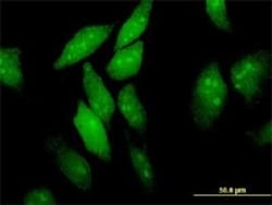 eIF4ENIF1 Antibody (2C4), Novus Biologicals 0.1 mg | Buy Online | Novus Biologicals | Fisher Scientific