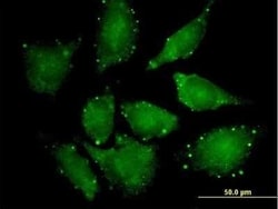 eIF4ENIF1 Antibody, Novus Biologicals 0.05 mg | Buy Online | Novus Biologicals | Fisher Scientific