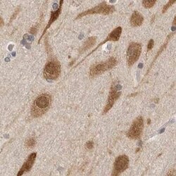 eIF4GII Antibody, Novus Biologicals 25 &mu;L | Buy Online | Novus Biologicals | Fisher Scientific
