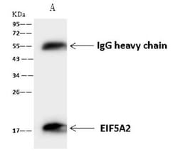 eIF5A2 Antibody, Novus Biologicals:Antibodies:Primary Antibodies