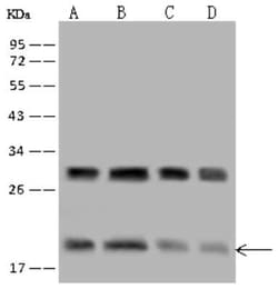 eIF5A2 Antibody, Novus Biologicals:Antibodies:Primary Antibodies