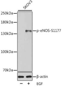 eNOS, p Ser1177 Antibody - Azide and BSA Free, Novus Biologicals 100 &mu;g;