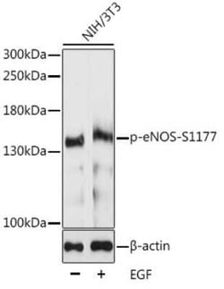 eNOS, p Ser1177 Antibody - Azide and BSA Free, Novus Biologicals 100 &mu;g;