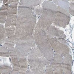 epithelial Sodium Channel alpha Antibody, Novus Biologicals:Antibodies:Primary