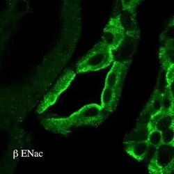 epithelial Sodium Channel beta Antibody, Novus Biologicals 100 &mu;g | Buy Online | Novus Biologicals | Fisher Scientific