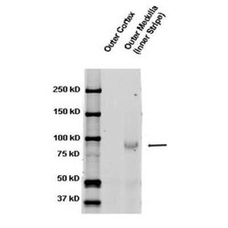 epithelial Sodium Channel beta Antibody, Novus Biologicals 100 &mu;g | Buy Online | Novus Biologicals | Fisher Scientific