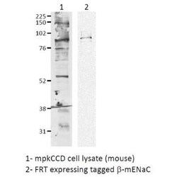 epithelial Sodium Channel beta Antibody, Novus Biologicals 100 &mu;g | Buy Online | Novus Biologicals | Fisher Scientific