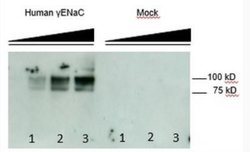 epithelial Sodium Channel gamma Mouse anti-Human, Clone: 3c7, Novus Biologicals:Antibodies:Primary