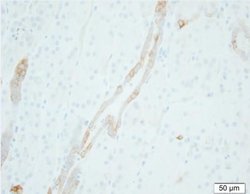 epithelial Sodium Channel gamma Mouse anti-Human, Clone: 5c2, Novus Biologicals