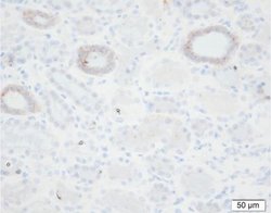 epithelial Sodium Channel gamma Mouse anti-Human, Clone: 11-35-1, Novus