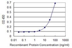 epithelial Sodium Channel gamma Antibody (2F3), Novus Biologicals 0.1 mg | Buy Online | Novus Biologicals | Fisher Scientific