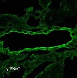 epithelial Sodium Channel gamma Antibody, Novus Biologicals 100 &mu;g;