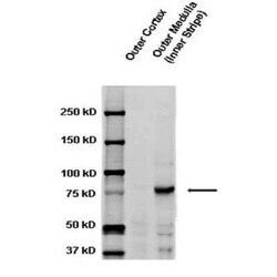 epithelial Sodium Channel gamma Antibody, Novus Biologicals 100 &mu;g;