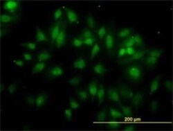 gamma-2 Tubulin Antibody (4F6), Novus Biologicals 0.1 mg, Unconjugated:Antibodies,