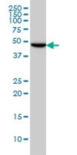 gamma-2 Tubulin Antibody (4F6), Novus Biologicals 0.1 mg, Unconjugated:Antibodies,