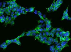 gamma Adducin Antibody, Novus Biologicals 100 &mu;g; Unconjugated:Antibodies,