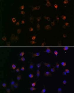 gamma Catenin Rabbit anti-Human, Mouse, Rat, Clone: 9O2K8, Novus Biologicals 20 &mu;g | Buy Online | Novus Biologicals | Fisher Scientific