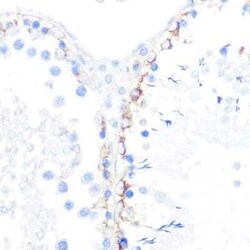 gamma Catenin Rabbit anti-Human, Mouse, Rat, Clone: 9O2K8, Novus Biologicals 20 &mu;g | Buy Online | Novus Biologicals | Fisher Scientific