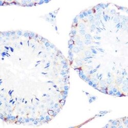 gamma Catenin Rabbit anti-Human, Mouse, Rat, Clone: 9O2K8, Novus Biologicals 20 &mu;g | Buy Online | Novus Biologicals | Fisher Scientific