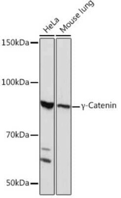 gamma Catenin Rabbit anti-Human, Mouse, Rat, Clone: 9O2K8, Novus Biologicals 20 &mu;g | Buy Online | Novus Biologicals | Fisher Scientific