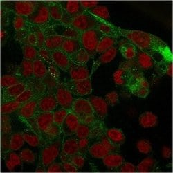 gamma Catenin Antibody (rCTNG/1664) - Azide and BSA Free, Novus Biologicals