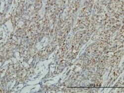 gamma Catenin Antibody (2G9), Novus Biologicals 0.1 mg | Buy Online | Novus Biologicals | Fisher Scientific