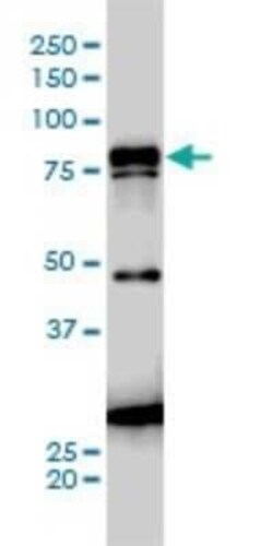 gamma Catenin Antibody (2G9), Novus Biologicals 0.1 mg | Buy Online | Novus Biologicals | Fisher Scientific
