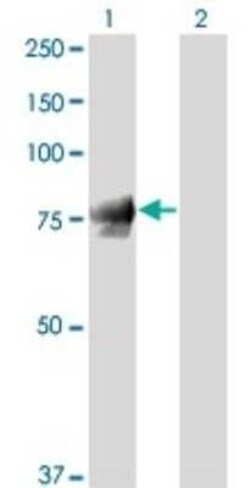 gamma Catenin Antibody (2G9), Novus Biologicals 0.1 mg | Buy Online | Novus Biologicals | Fisher Scientific