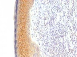 gamma Catenin Antibody (CTNG/1483), Novus Biologicals:Antibodies:Primary
