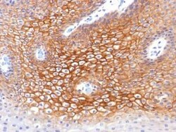 gamma Catenin Antibody (CTNG/1483), Novus Biologicals:Antibodies:Primary