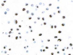 Histone H2AX, p Ser139 Antibody (BLR053F), Novus Biologicals 100 &mu;g | Buy Online | Novus Biologicals | Fisher Scientific