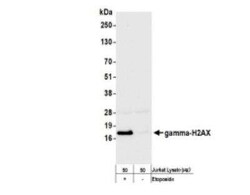 Histone H2AX, p Ser139 Antibody (BLR053F), Novus Biologicals 100 &mu;g | Buy Online | Novus Biologicals | Fisher Scientific