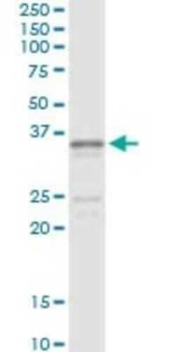 gamma Sarcoglycan Antibody (3C5), Novus Biologicals 0.1 mg | Buy Online | Novus Biologicals | Fisher Scientific