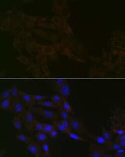 gamma Tubulin Rabbit anti-Human, Mouse, Rat, Clone: 5R3N3, Novus Biologicals:Antibodies:Primary