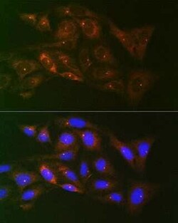 gamma Tubulin Rabbit anti-Human, Mouse, Rat, Clone: 5R3N3, Novus Biologicals:Antibodies:Primary