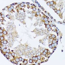 gamma Tubulin Rabbit anti-Human, Mouse, Rat, Clone: 5R3N3, Novus Biologicals:Antibodies:Primary