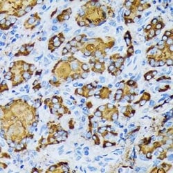 gamma Tubulin Rabbit anti-Human, Mouse, Rat, Clone: 5R3N3, Novus Biologicals:Antibodies:Primary