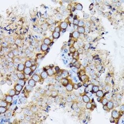 gamma Tubulin Rabbit anti-Human, Mouse, Rat, Clone: 5R3N3, Novus Biologicals:Antibodies:Primary