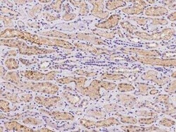 gamma-glutamyl hydrolase Antibody, Novus Biologicals 50 &mu;g; Unconjugated:Antibodies,