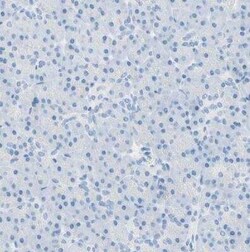gp130/CD130 Antibody, Novus Biologicals 0.1 mL | Buy Online | Novus Biologicals | Fisher Scientific