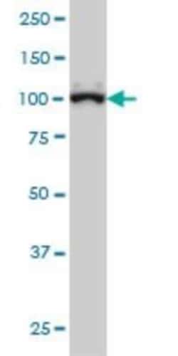 gtf3c3 Antibody (2D8), Novus Biologicals 100 &mu;g | Buy Online | Novus Biologicals | Fisher Scientific