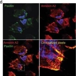 Annexin A2 Antibody (1G7), Novus Biologicals 0.1 mg | Buy Online | Novus Biologicals | Fisher Scientific