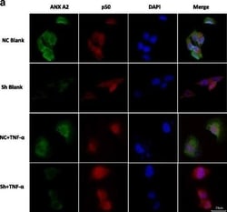 Annexin A2 Antibody (1G7), Novus Biologicals 0.1 mg | Buy Online | Novus Biologicals | Fisher Scientific