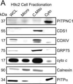 CDS1 Antibody (2D10), Novus Biologicals 0.1 mg, Unconjugated:Anticorps,
