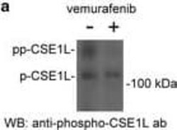 CSE1L/CAS/Exportin-2 Antibody (3D8), Novus Biologicals 0.1 mg | Buy Online | Novus Biologicals | Fisher Scientific