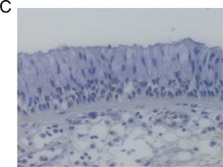 Cystatin SN Antibody, Novus Biologicals 0.05 mg | Buy Online | Novus Biologicals | Fisher Scientific