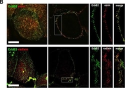 Radixin Antibody (1E12), Novus Biologicals 0.05 mg | Buy Online | Novus Biologicals | Fisher Scientific