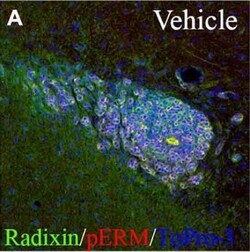 Radixin Antibody (1D9), Novus Biologicals 0.1 mg | Buy Online | Novus Biologicals | Fisher Scientific